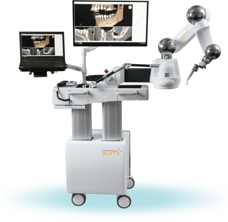 robot assisted dental implants
