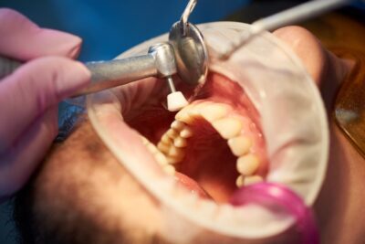 bleeding gums, gum disease