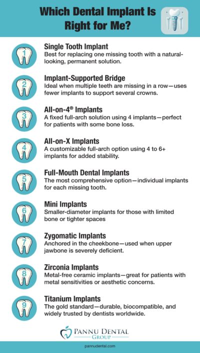 different types of dental implants infographic for San Jose Dental Implants