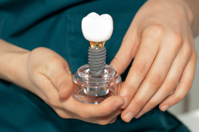 dentist holding a dental implant