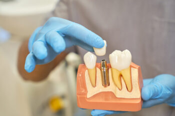 dental implant specialist showing which type of dental implant is best for patient 