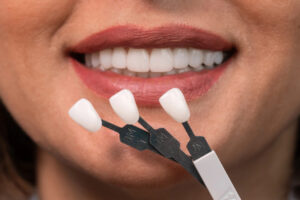veneers for dental restoration and full smile makeover 